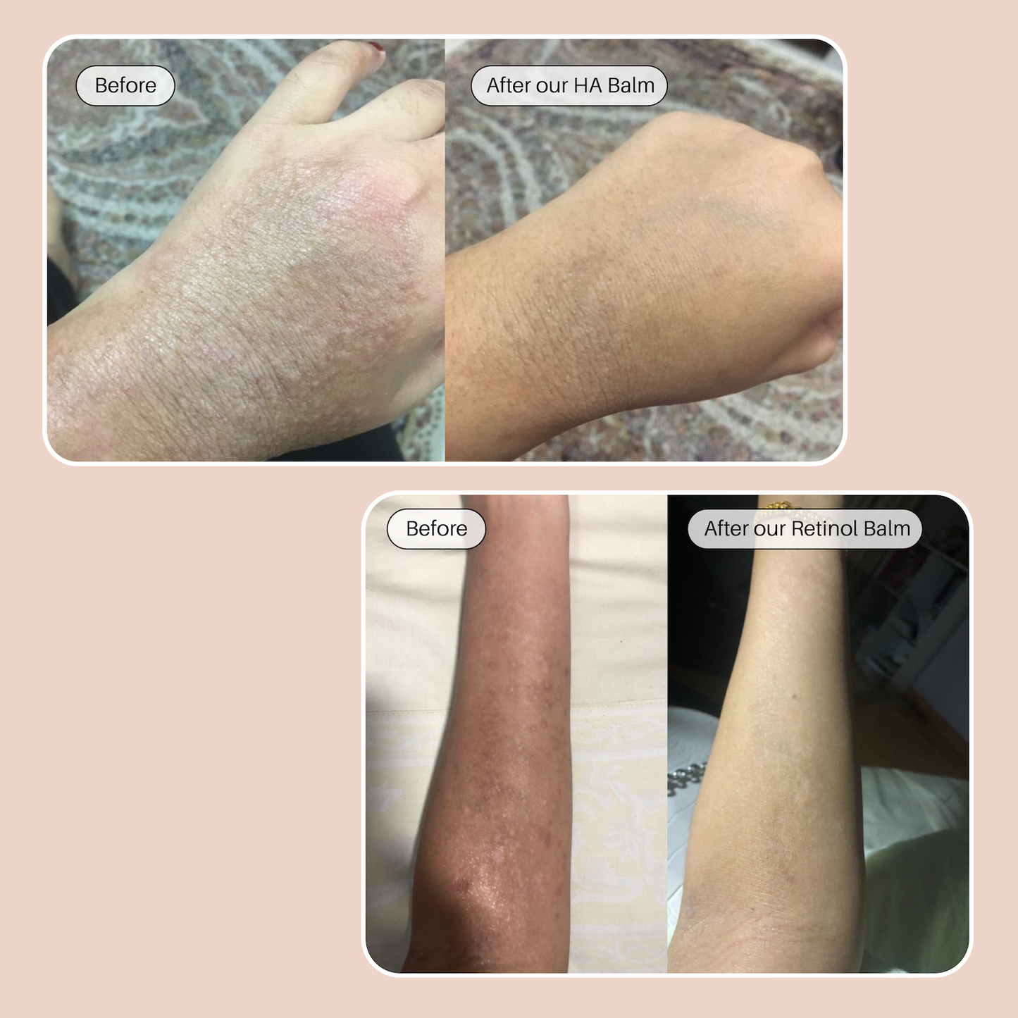 The Dream Team - HA & Retinol Balm
