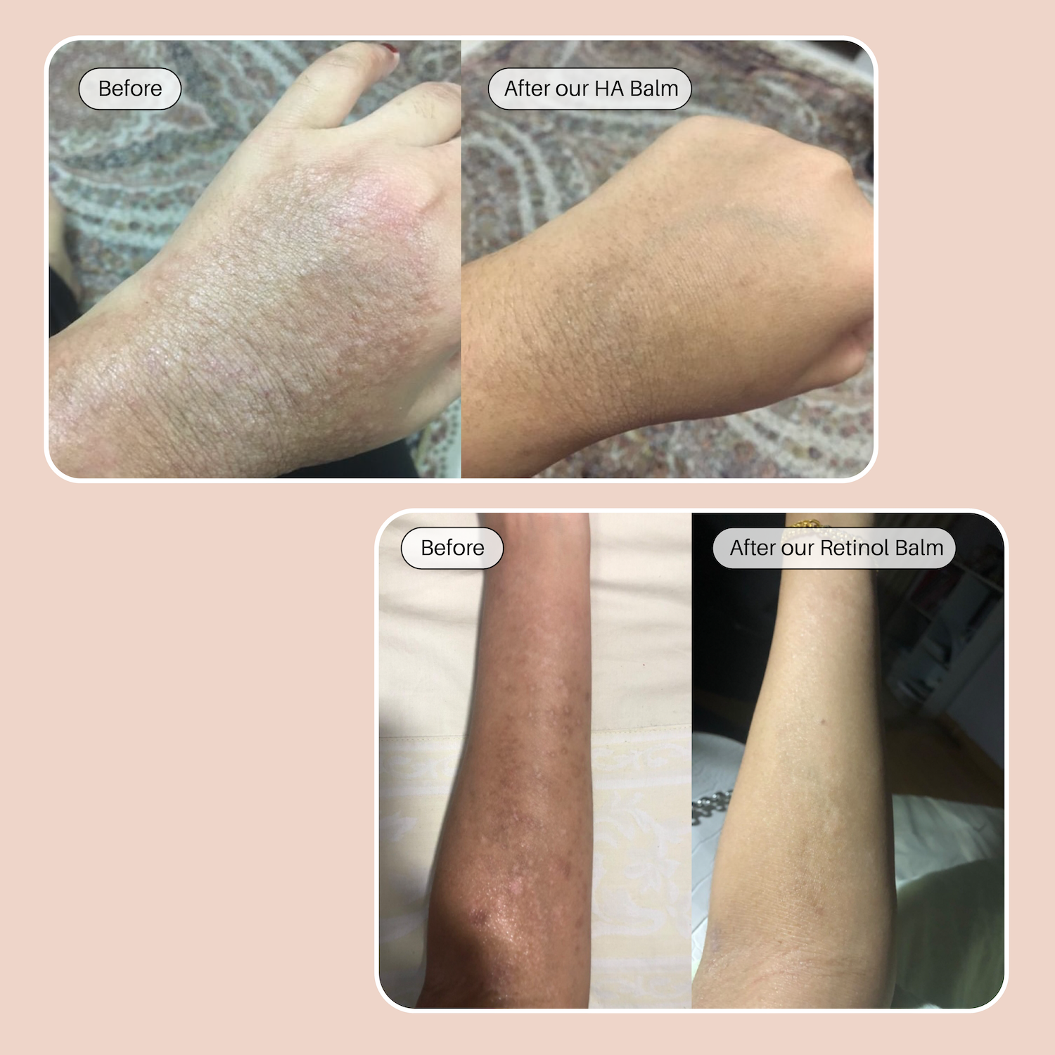The Dream Team - HA & Retinol Balm