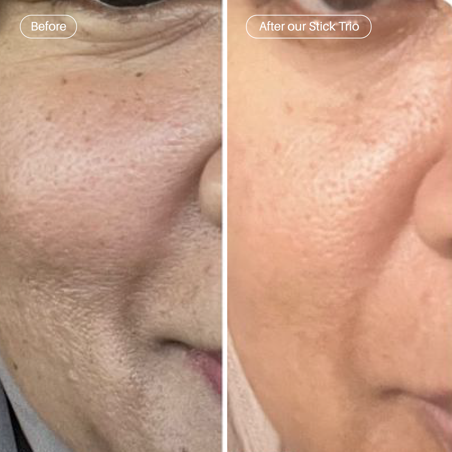 Stick Trio - HA, Retinol, Sun Stick