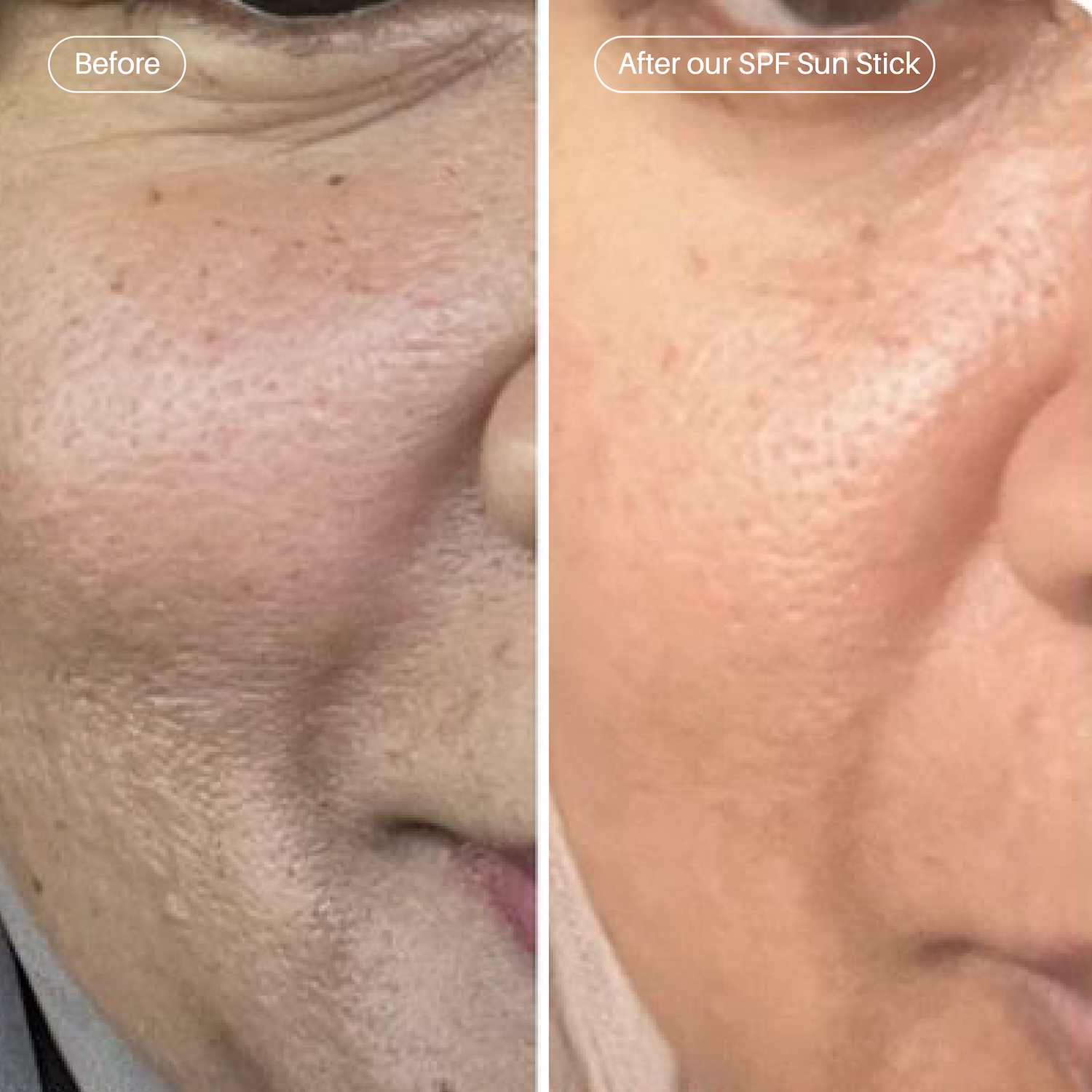 Sun Stick SPF50++++ Sunscreen with Niacinamide